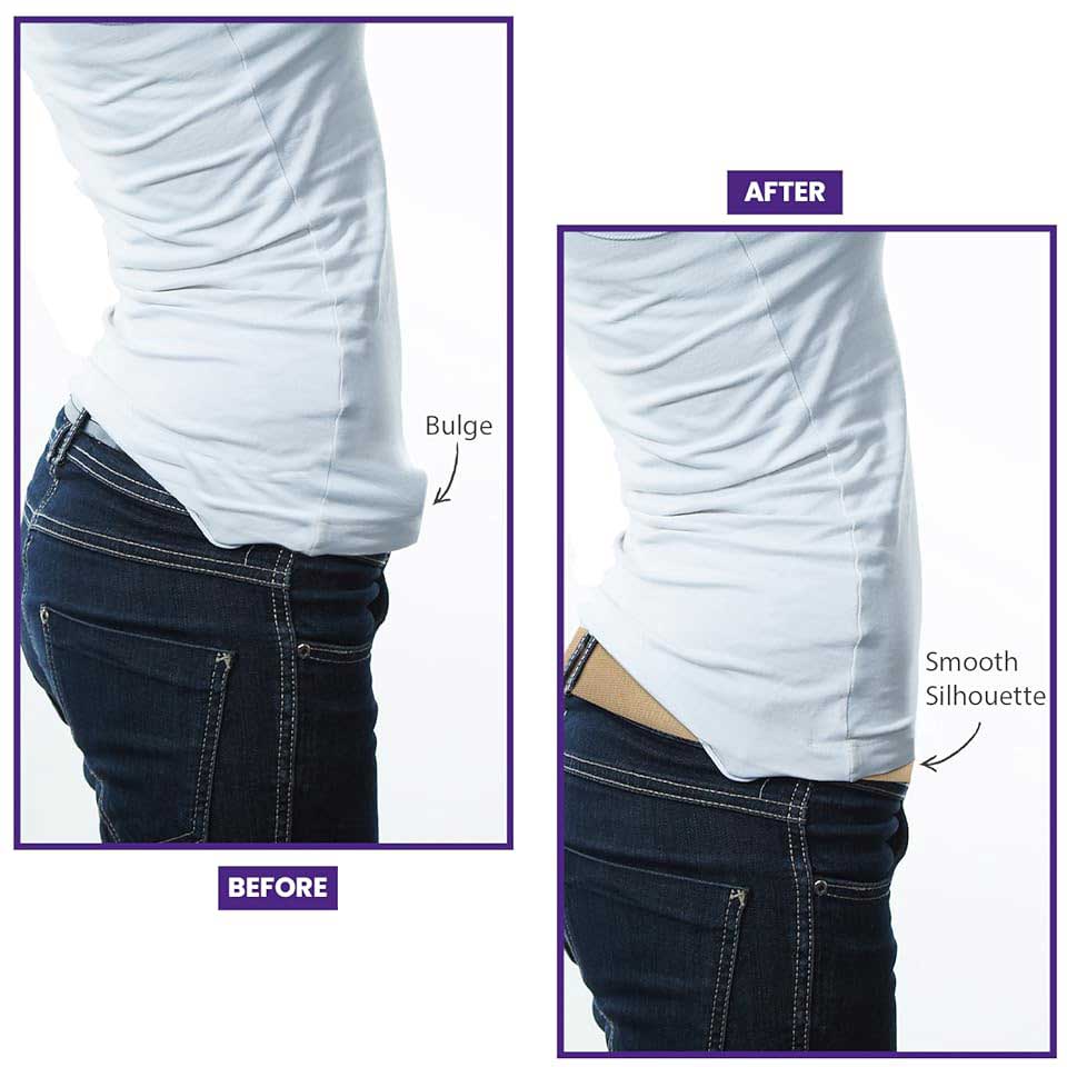 Before and After Beltaway showing no Buckle Bulge